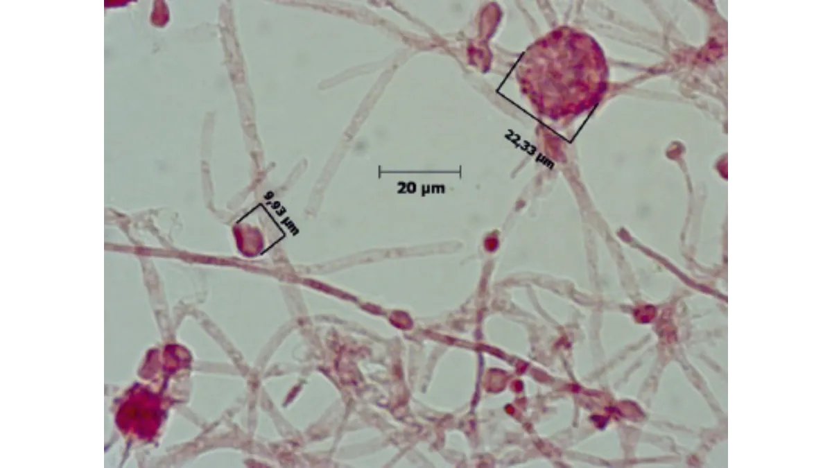 Präparat Monascus ruber 1 Stück Alle Infos ansehen